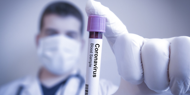 حالات الإصابة بفيروس كورونا تواصل ارتفاعها على مستوى العالم